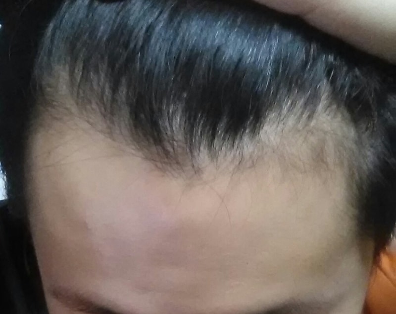 20150322_210539-1.jpg