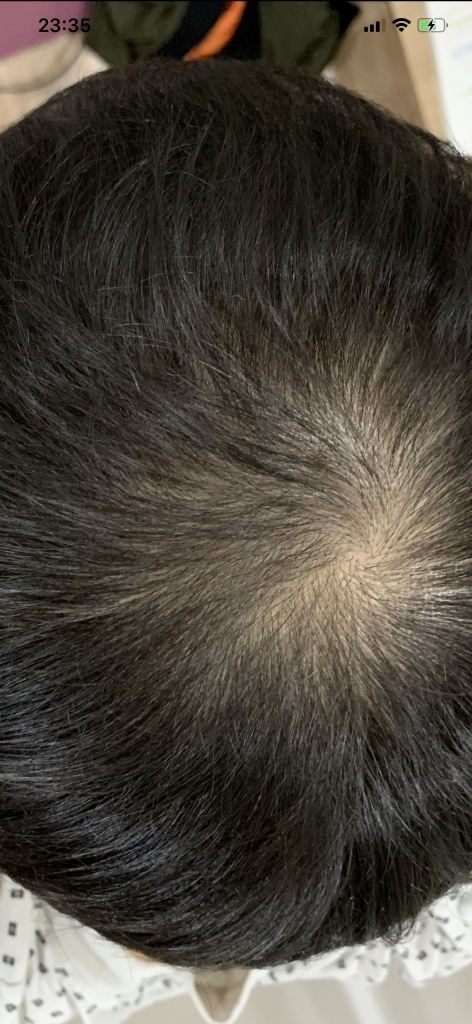 2E5961B3-0C42-4065-8054-83F2B3E11C43.png