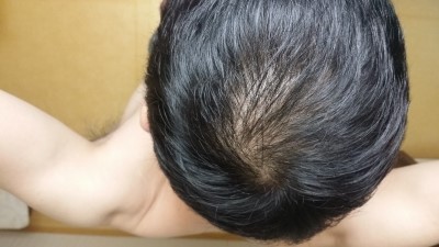 20151127_090817.jpg