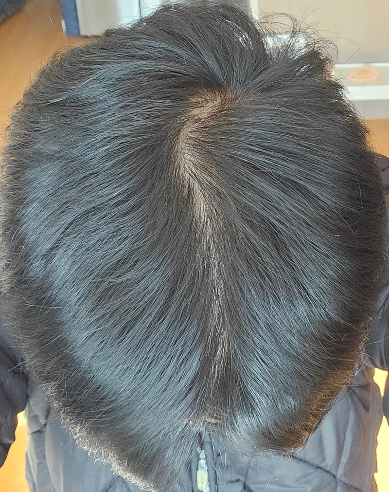 1000008884.jpg