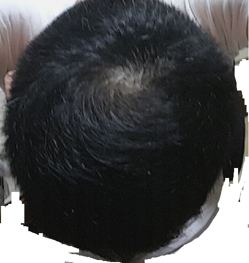 제목 없음2.png