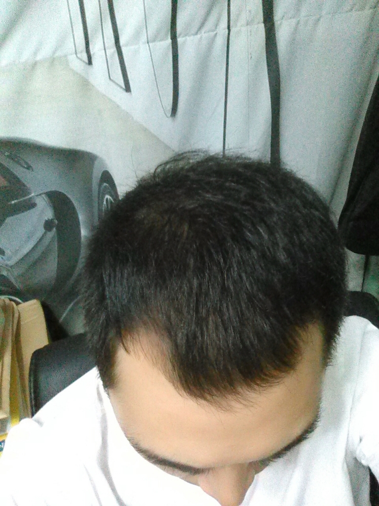 CAM00330.jpg