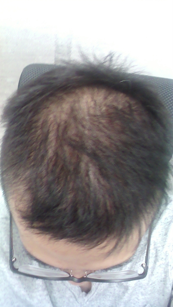 20170419_0014518.jpg