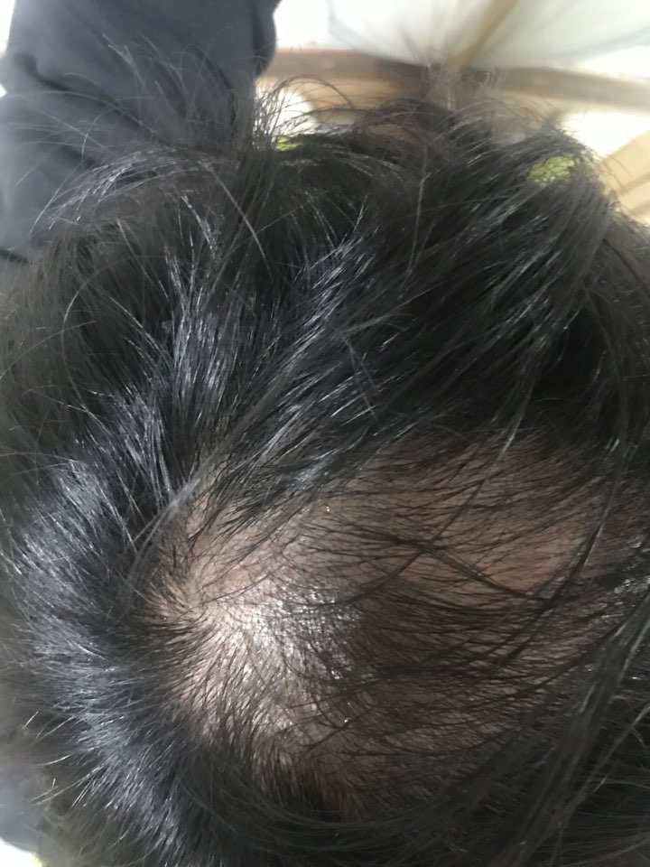 KakaoTalk_20181119_180504592.jpg