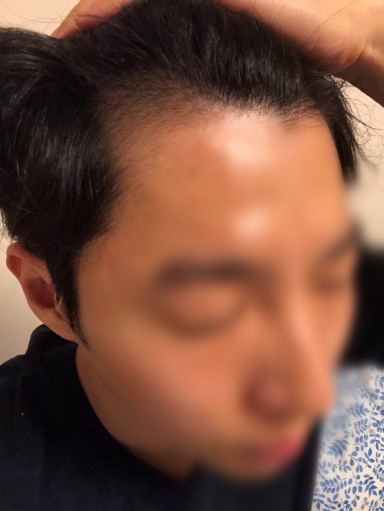 Facetune_18-11-2018-03-17-36.jpg