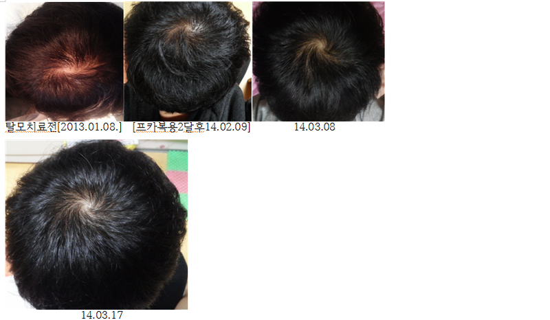 머리사진 1.png
