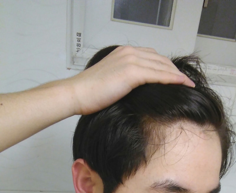20170801_031730.jpg