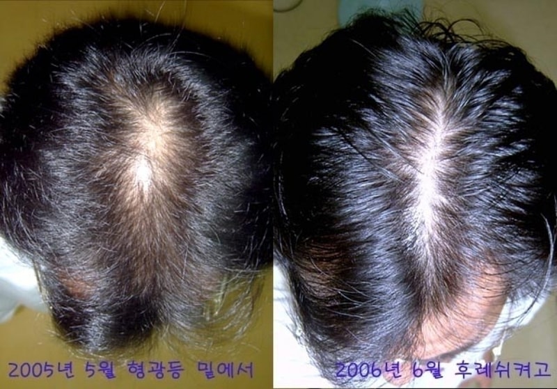 hair-02.jpg