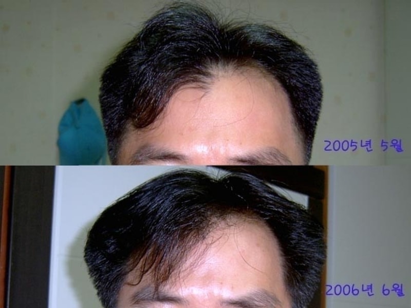 hair-03.jpg