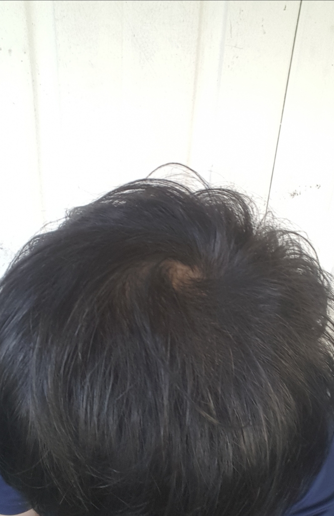 20170831_180507.jpg