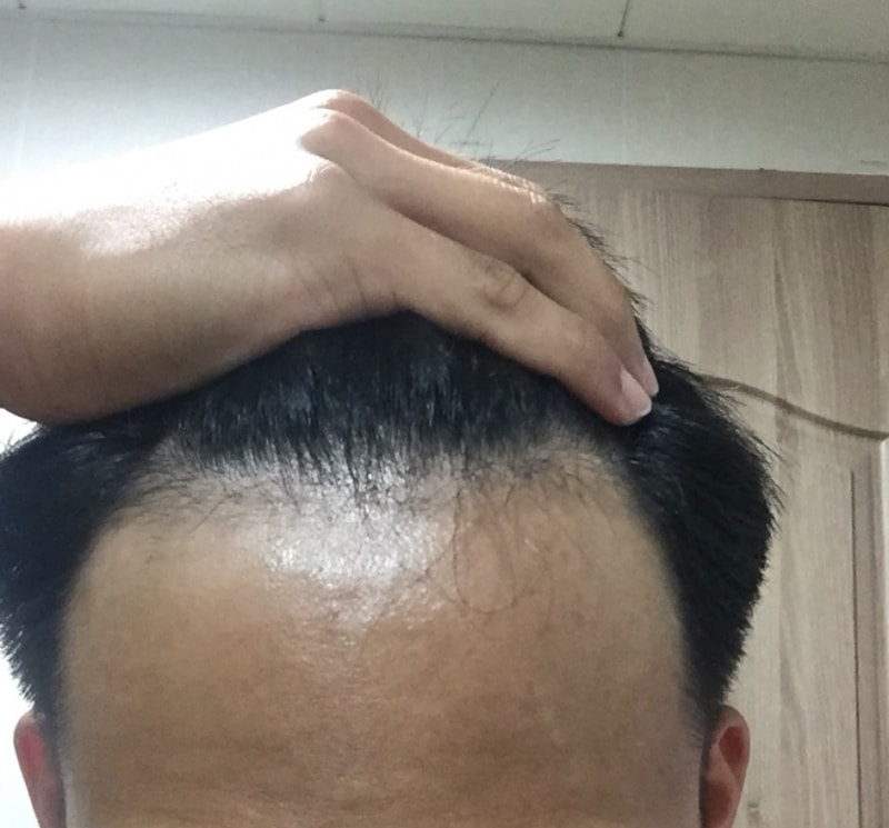 984499F3-3177-4A5B-ABCB-390246D38DAE.jpeg