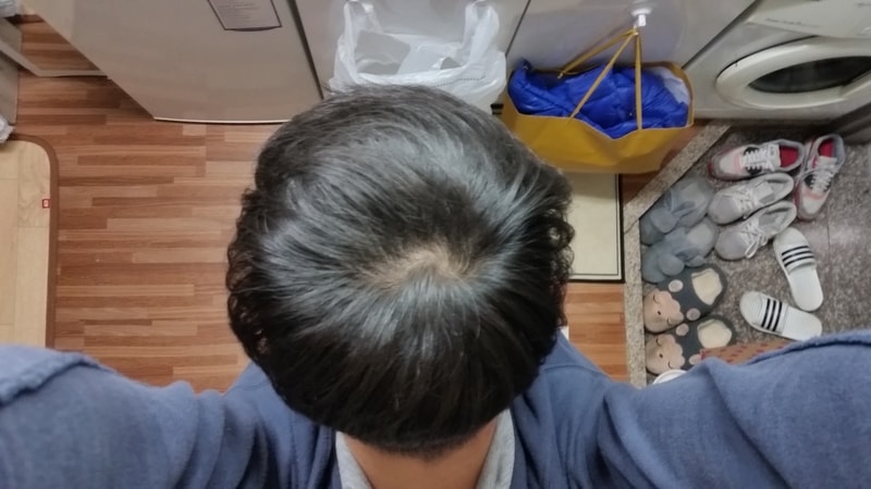 20170306_5개월.jpg