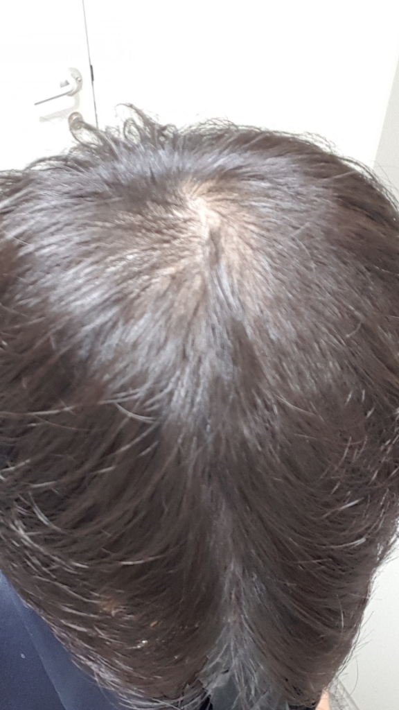 Screenshot_20190613-163817_Gallery.jpg
