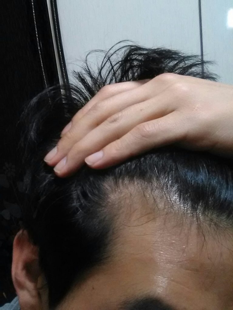 20141006_214812.jpg