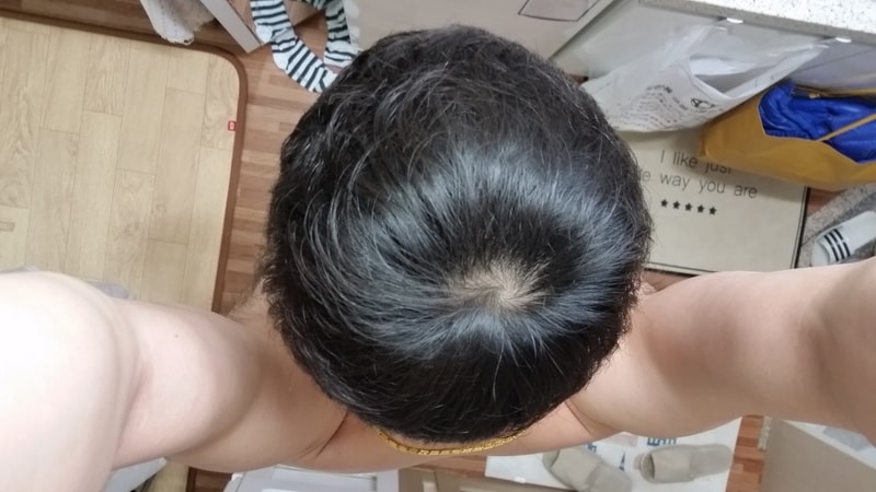 20170403_6개월.jpg