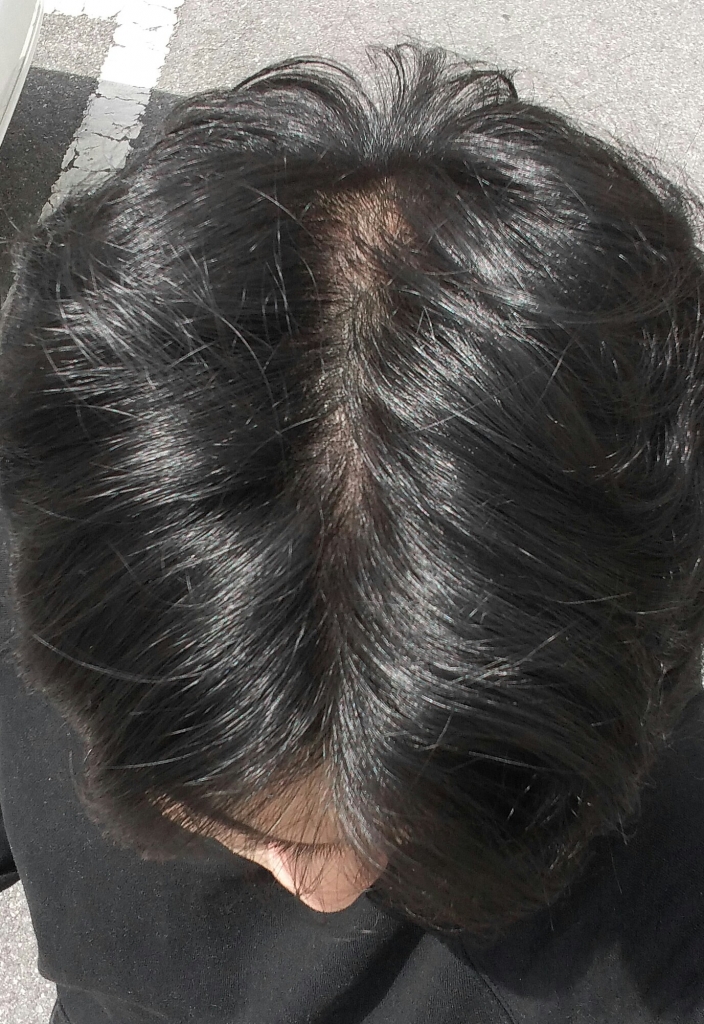 20170407_130849_HDR-1.jpg