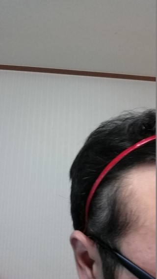 20151014_오른쪽이마2.jpg