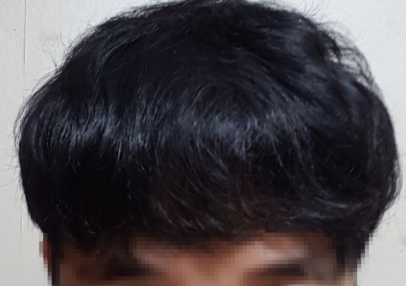 후 정면.jpg