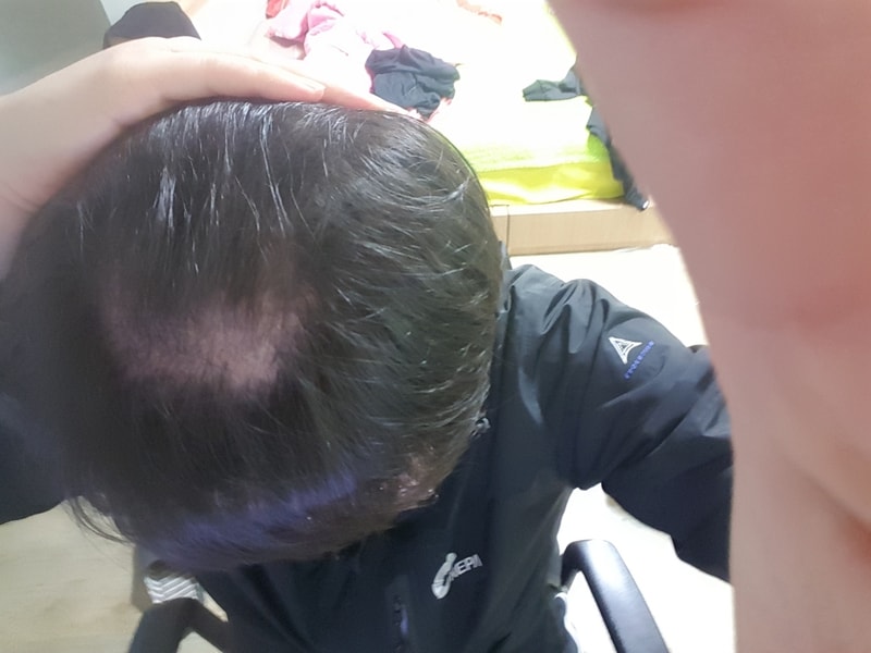 후.jpg