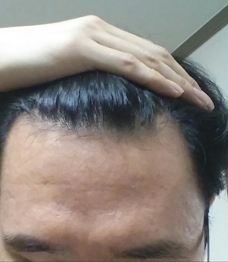 프페전1.jpg