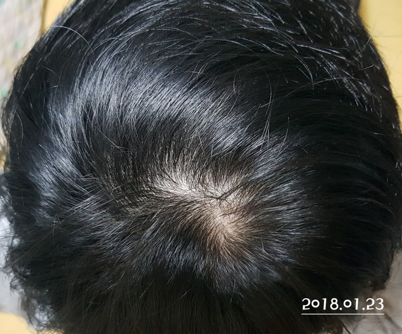 20180123_234313.jpg