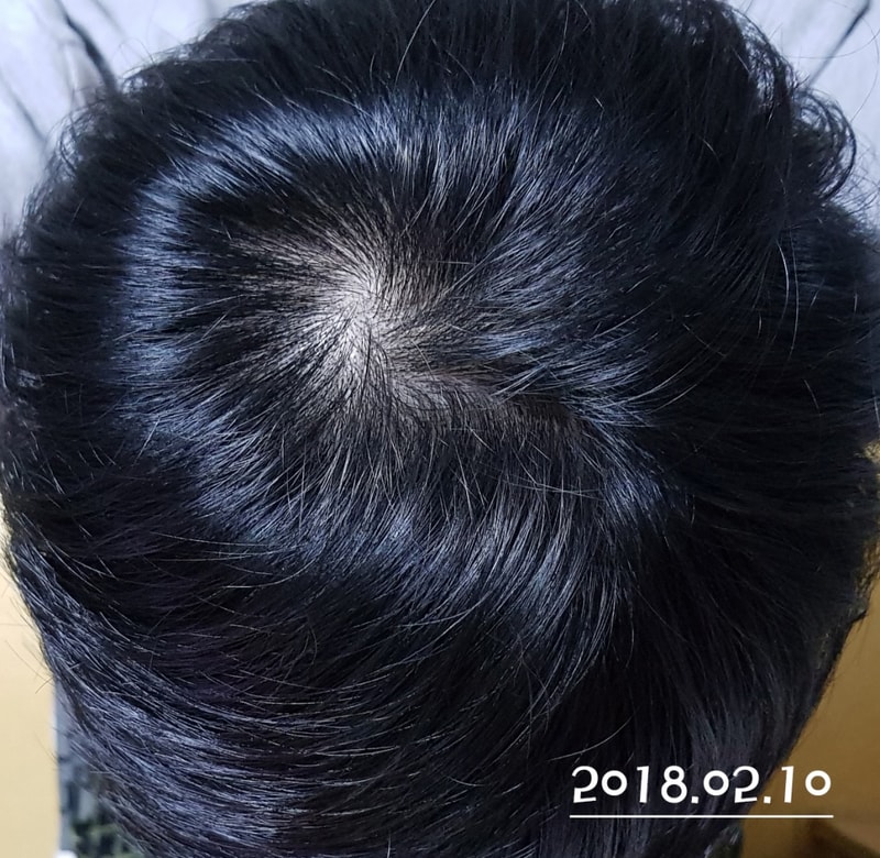 20180210_191047.jpg