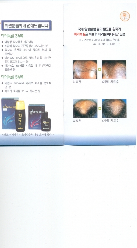 마이녹실임상실험.jpg