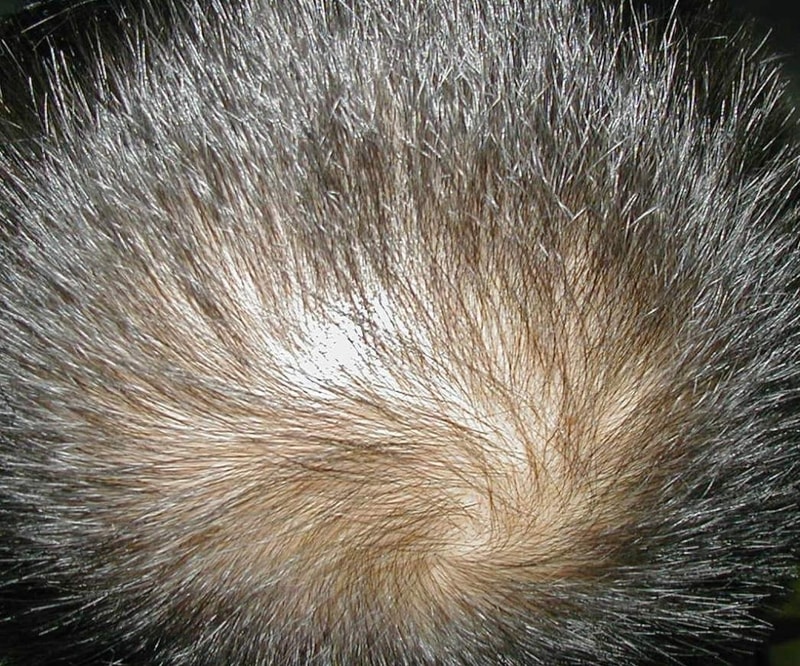 정수리1.jpg