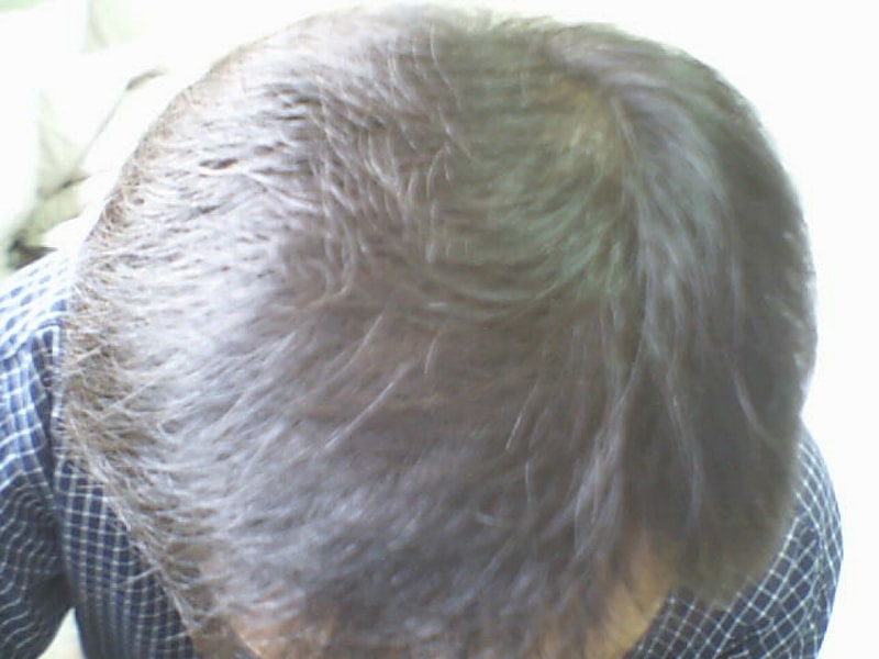 MyImage1008_03.jpg