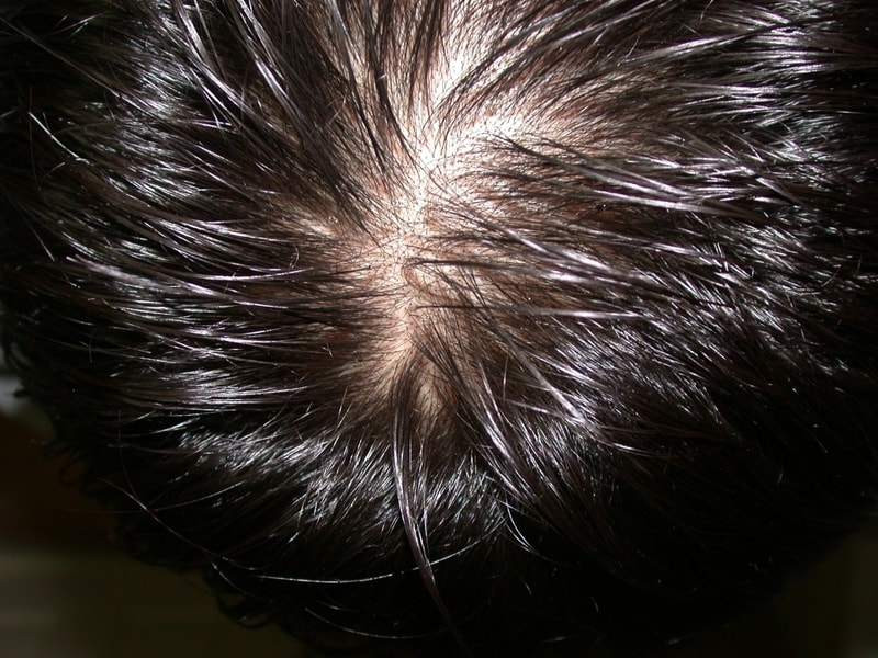hair.jpg