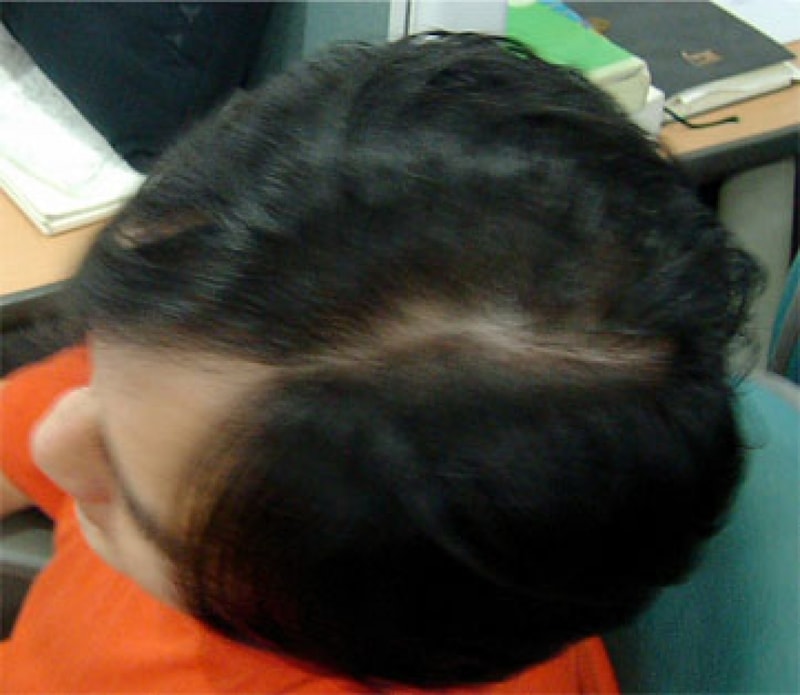 myhead.jpg