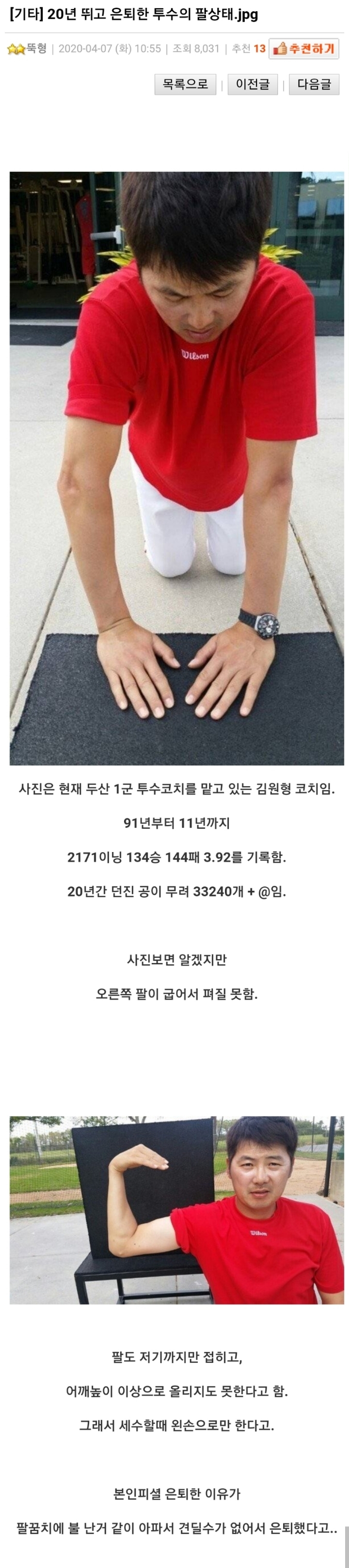 20년_뛰고_은퇴한_투수의_팔상태.jpg