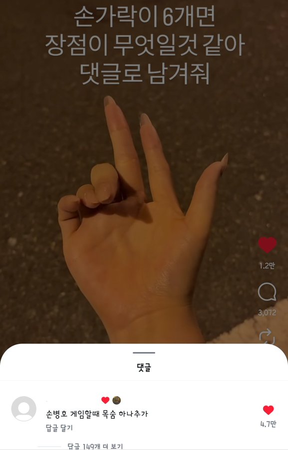 손가락 6개일 때 장점