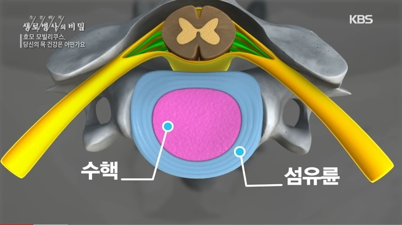 목디스크.jpg