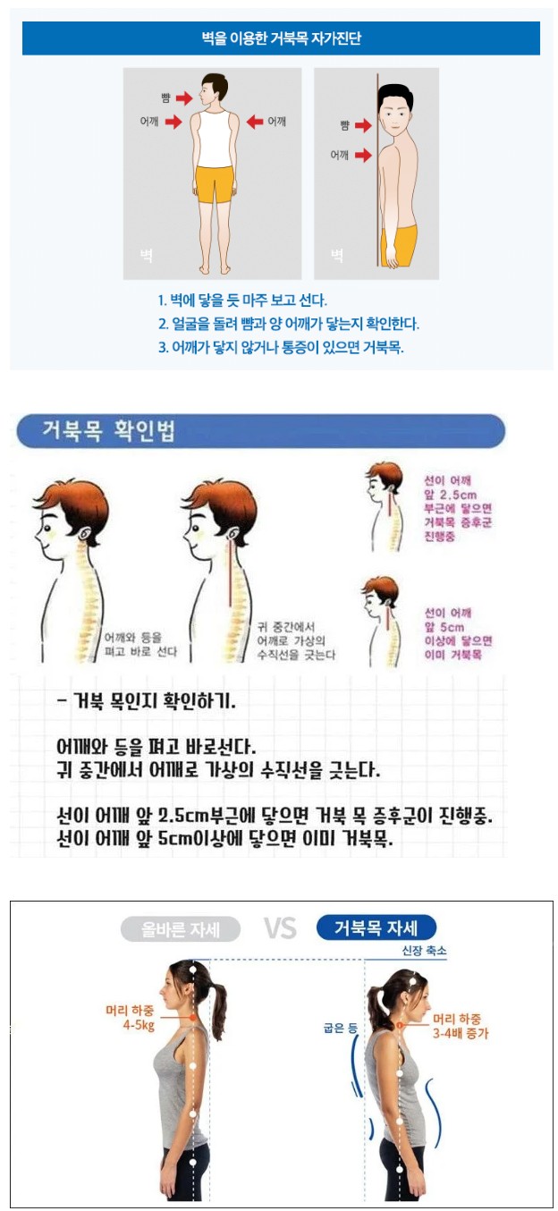 간단한_거북목_자가_진단_방법.jpg