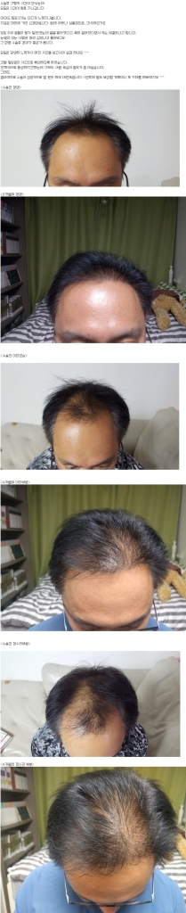 6개월사진.jpg