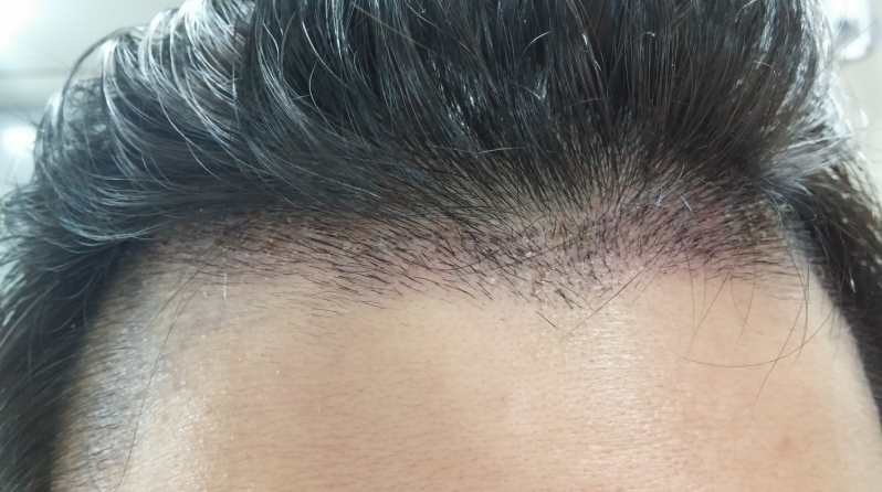 20150813_221320.png