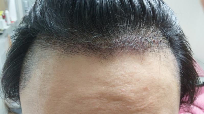 20150813_221526.png