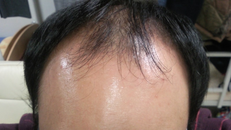 이마1.jpg