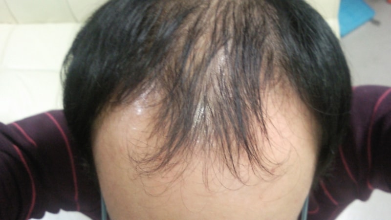이마3.jpg
