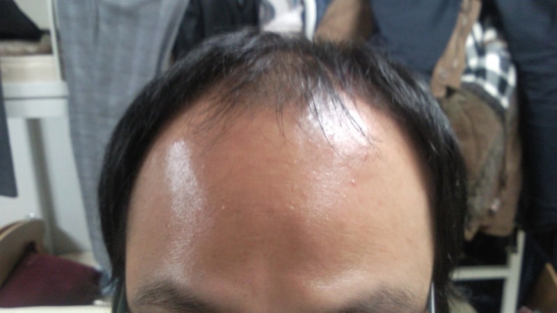 이마2.jpg