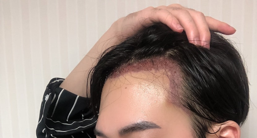 하루뒤
