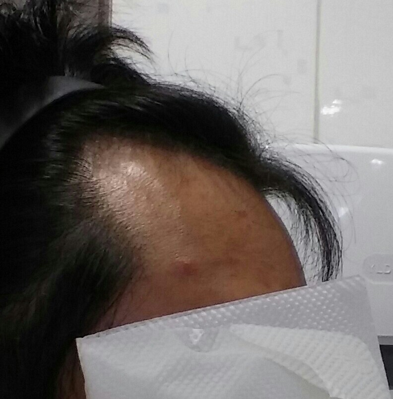 오른쪽전.png