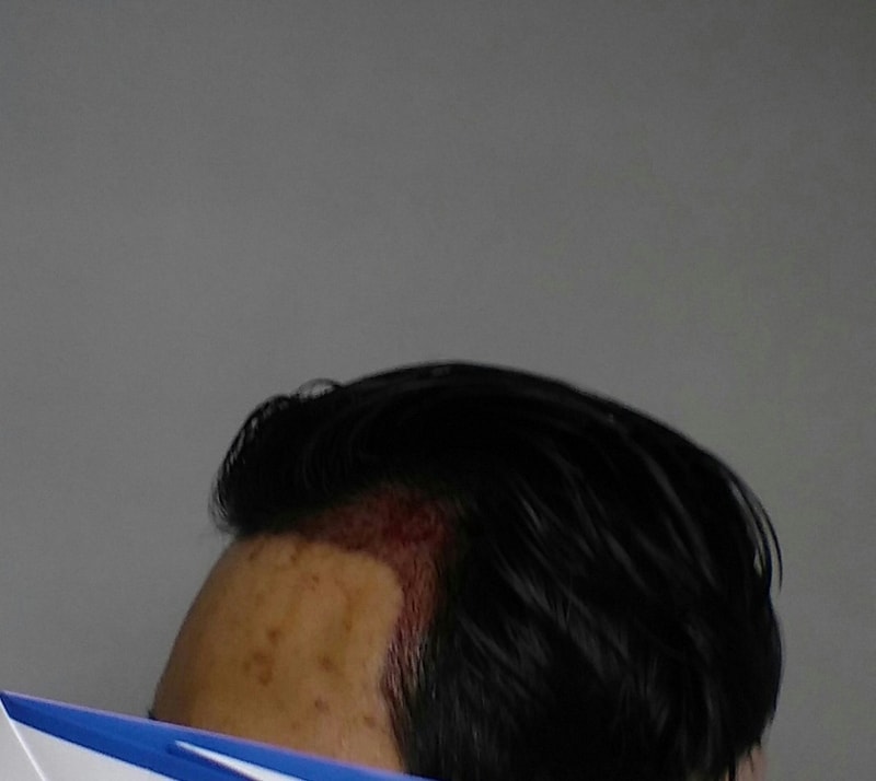 왼쪽후.png