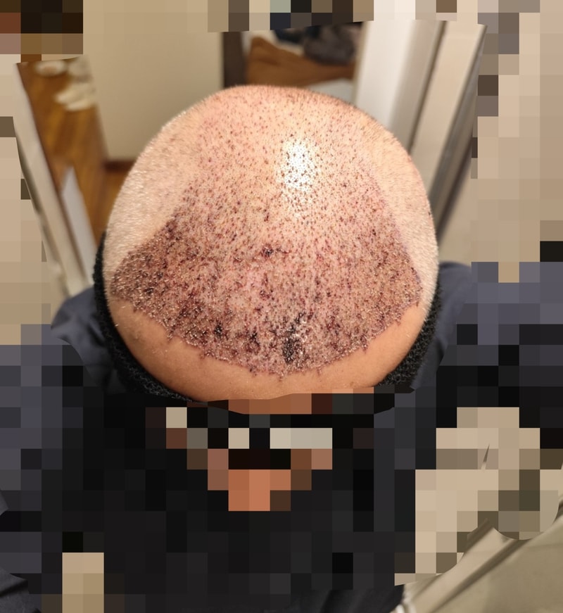1000013182.jpg
