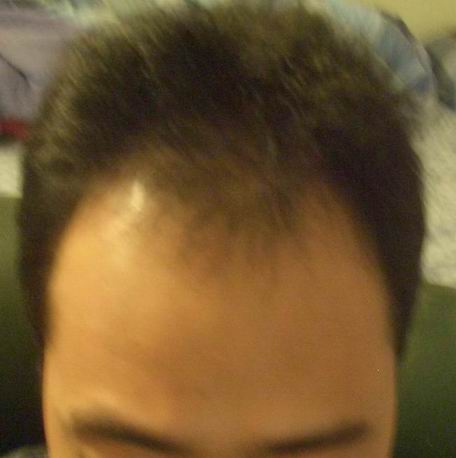 before1.jpg