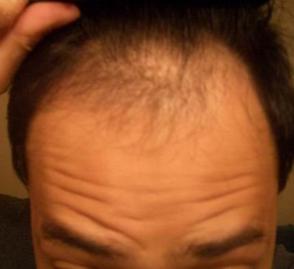 before2.jpg