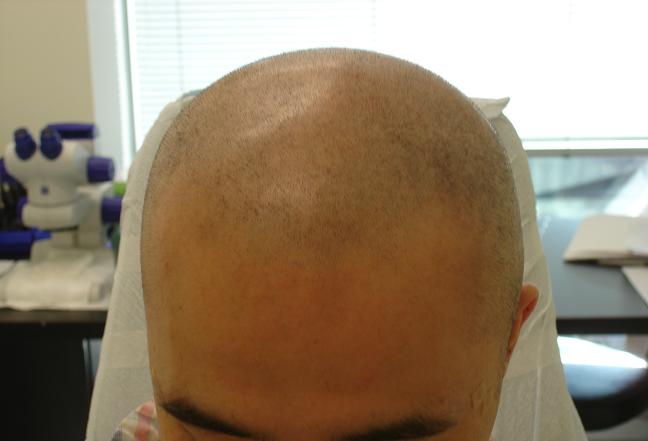 BeforeFront.JPG