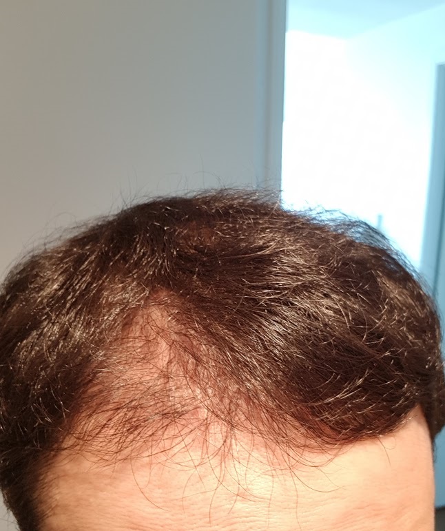 20180430_103830.jpg