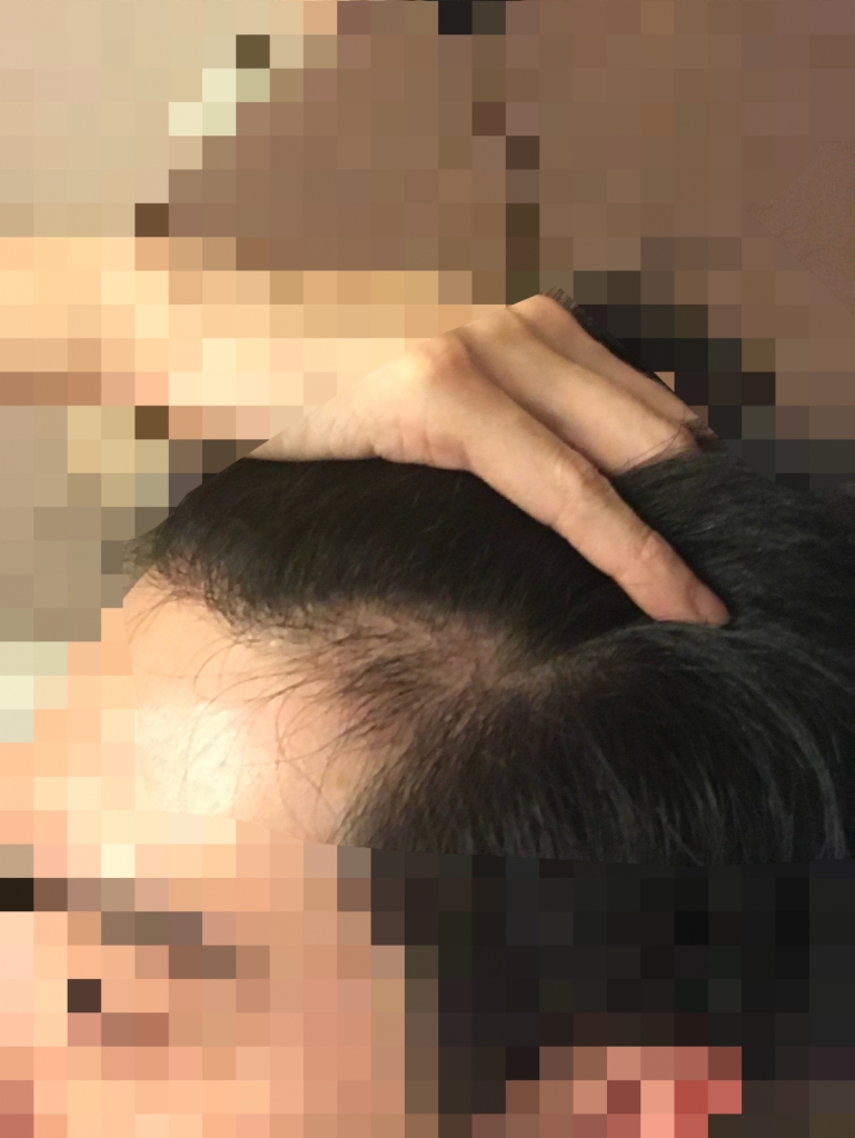 FA6F94AB-7B80-4A0A-8F45-7A6A78D89CCC.png